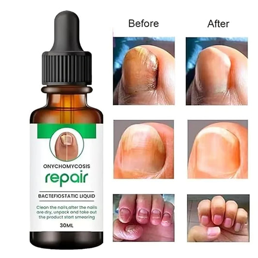 Nails Repair Serum Decoration |Strong, Supple and Shaped Nail Care Serum