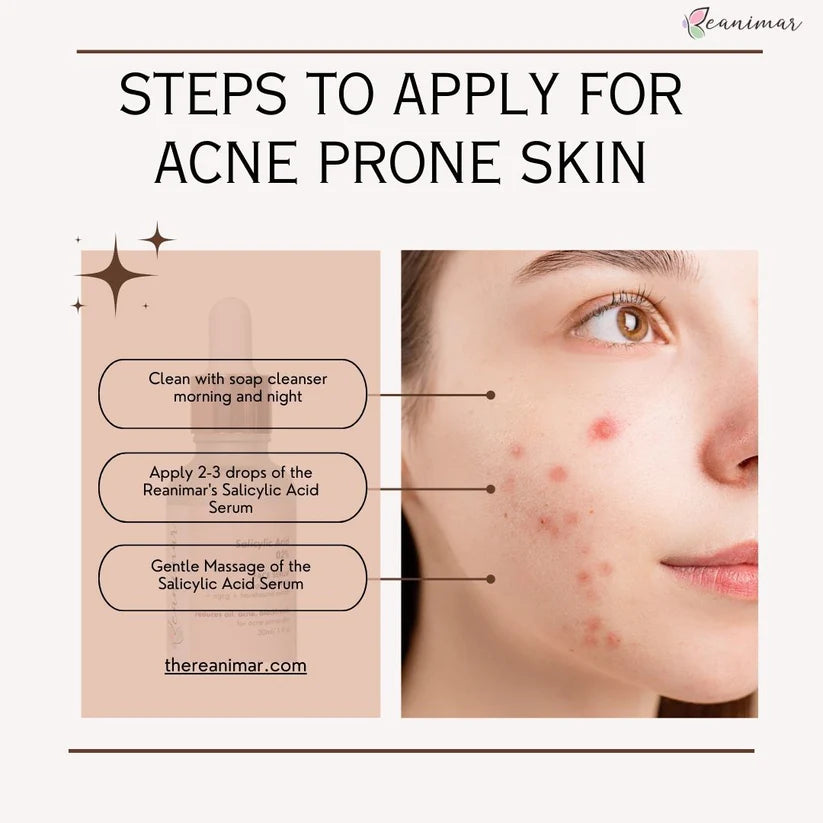 Salicylic - Acne Control Face Serum