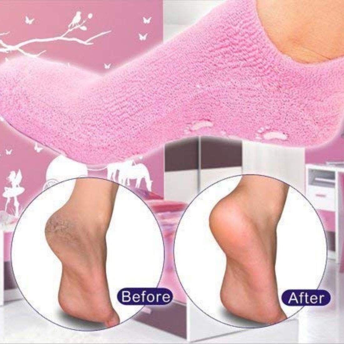 Moisturizing Gel Socks